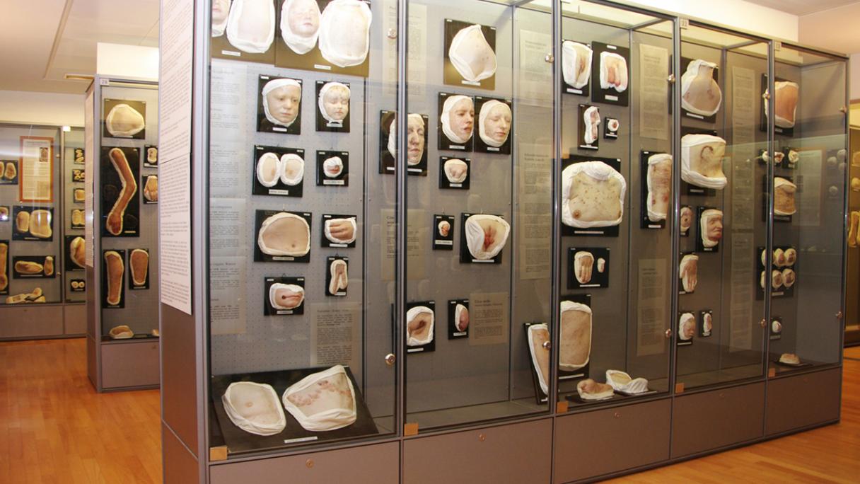 Showcases at the Moulagenmuseum of the University and University Hospital Zurich